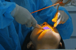 laser periodontal therapy
