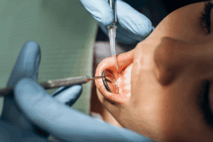 Gum Disease Treatment