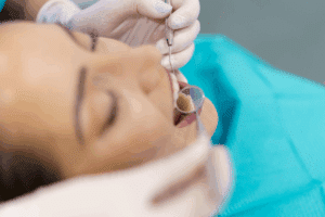 Periodontal Treatment