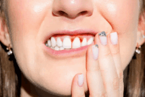 gum disease treatment