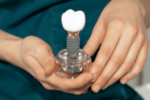 Dental Implants
