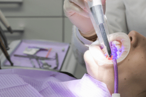 laser periodontal therapy
