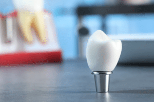 Natural-Looking Tooth Replacement Options